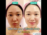 SOMEBYMI AHA BHA PHA 30 Days Miracle Cleansing Bar Soap 106g